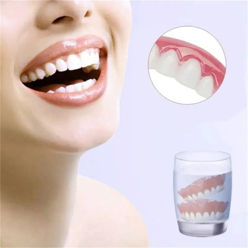 Prothèses dentaires supérieures Perfect Smile