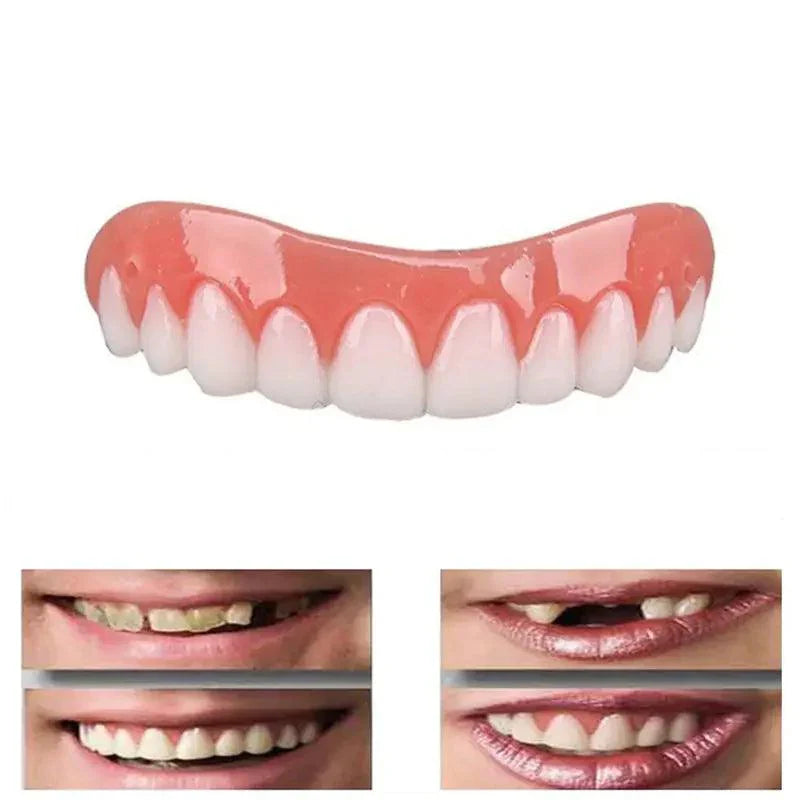 Prothèses dentaires supérieures Perfect Smile
