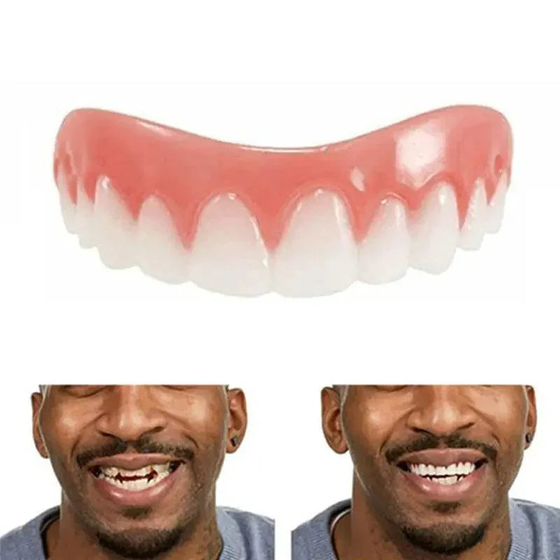 Prothèses dentaires supérieures Perfect Smile